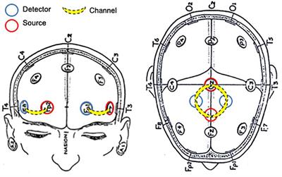 Neural Substrates of Cognitive Motor Interference During Walking; Peripheral and Central Mechanisms